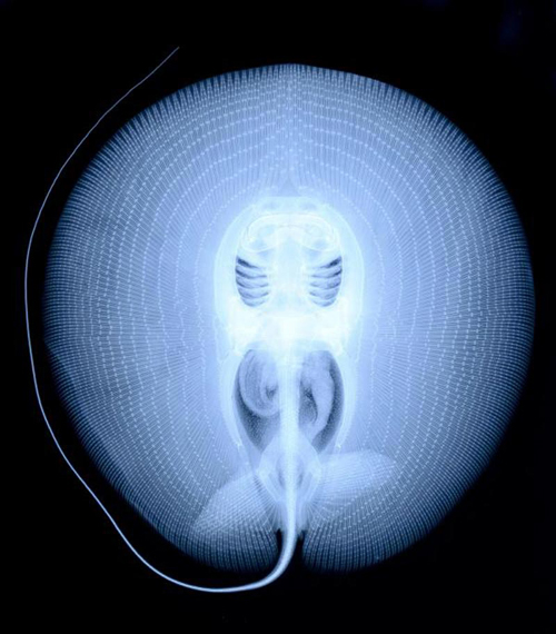 Chụp X-quang - hình nền máy tình đẹp